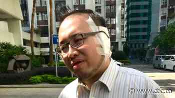 Ear bitten off, pro-democracy politician sees Sunday elections as a way Hong Kong can express its anger