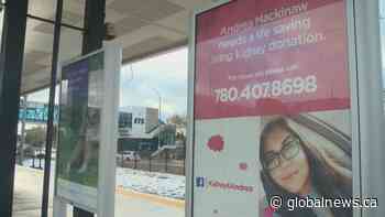 Edmonton woman buys LRT ads to find a kidney donor
