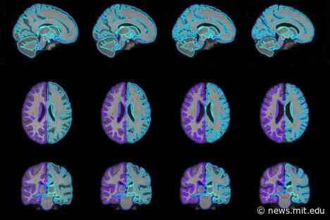 Producing better guides for medical-image analysis