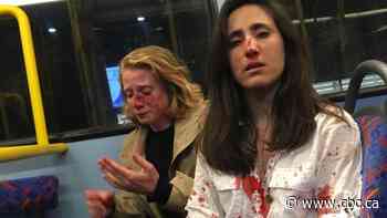 3 youths plead guilty to London bus attack of lesbian couple