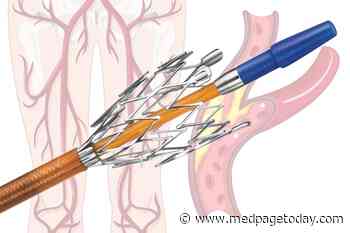 Long Leg Lesions: Stents Not Better Than Surgery