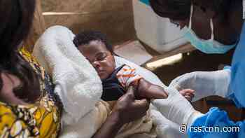 Measles has claimed more than twice as many lives as Ebola in DRC