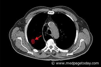 Clinical Challenge: Lung Cancer Screening Utilization