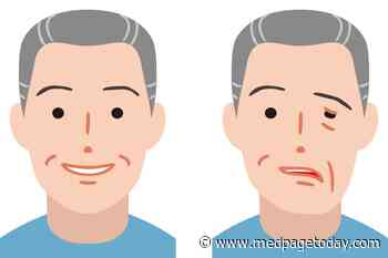 What Caused Ischemic Stroke in Healthy 51-Year-Old?