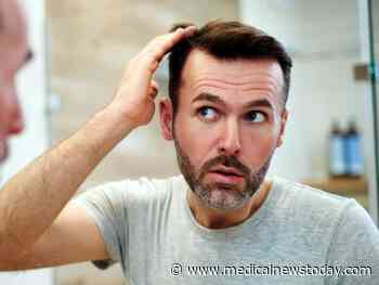 How much hair loss is normal?