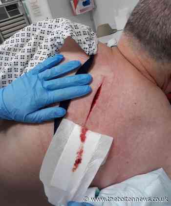 Taxi driver suffers serious stab wound during Darwen garage robbery bid