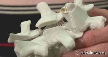 U of A-developed micro-implant could restore spinal function in patients dealing with paralysis
