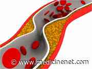 Especially in the Young, Cholesterol Is No Friend to the Heart