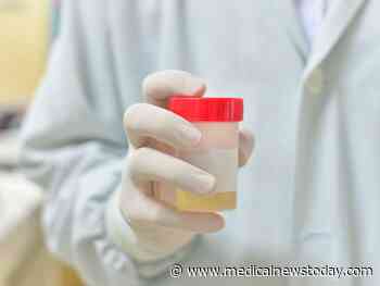 Medical News Today: Prostate cancer: Home urine test could 'revolutionize diagnosis'