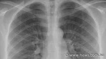 Doctors link vaping to ‘lung scarring’