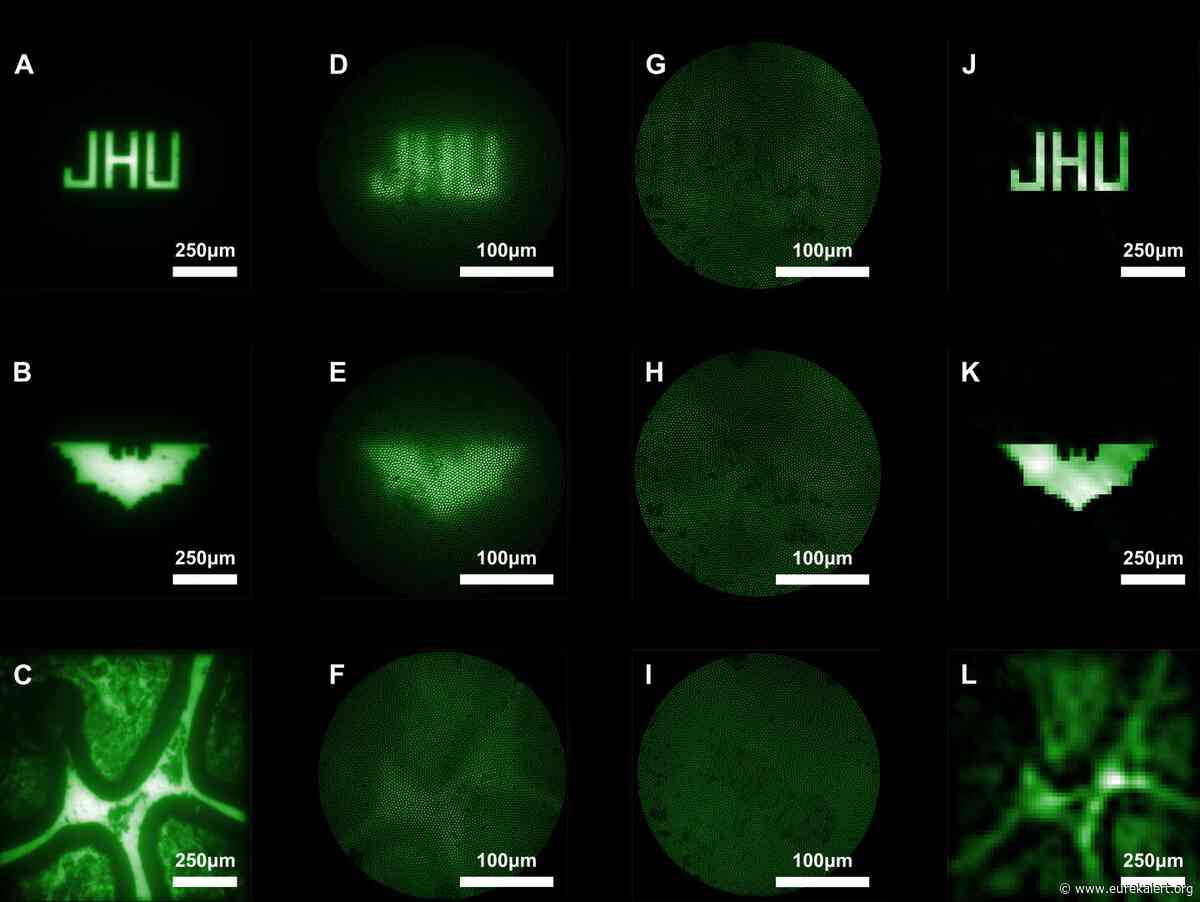 New ultra-miniaturized scope less invasive, produces higher quality images
