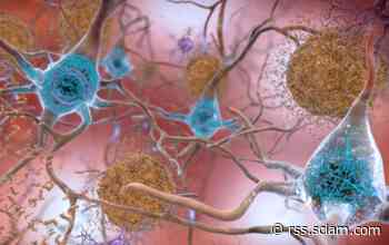 Reassessment of Alzheimer's Drug Raises Hope--and Concerns