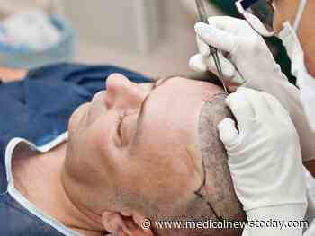 Medical News Today: How effective are different hair transplant methods?
