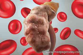 Clinical Challenges: Anemia in Chronic Kidney Disease