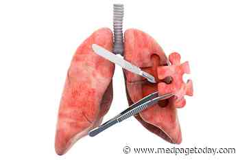 Geography Explains Lung Surgery Disparities
