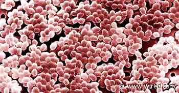 Scientists Find a Weak Spot in Some Superbugs' Defenses