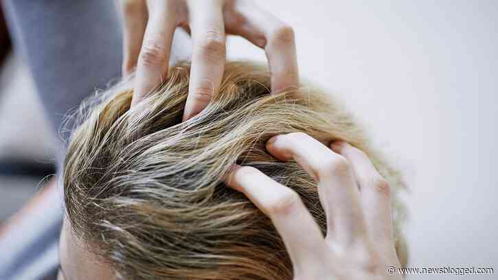 here get the advantages of Hair transplant