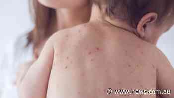 Fears as child-killing disease spreads