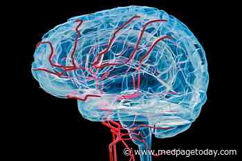 Off-Label Thrombolytic Could 'Rescue' Stroke Thrombectomy