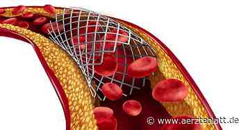 Zweifel an Gleichwertigkeit von Bypass und Stent bei Hauptstammstenose