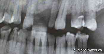 Concerns raised about 4.4 per cent increase in Alberta dental fee guide; patients encouraged to shop around for services