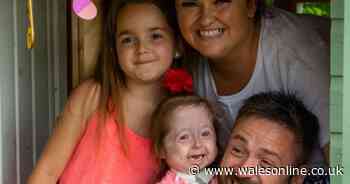 This toddler's the only child in the world with this life-threatening condition