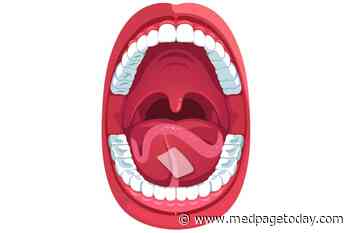 Sublingual Apomorphine Shows Benefit in Parkinson's