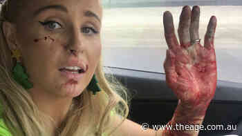 Blogger and WAG Annie Nolan pleads for help after dog attack