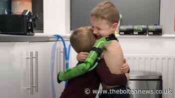 Boy, 5, given prosthetic arm that lets him hug brother for first time