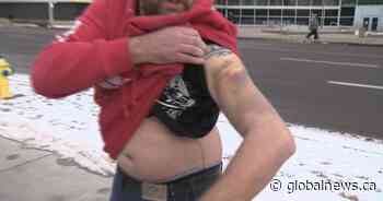 Alberta police watchdog investigates after man injured during arrest in central Edmonton