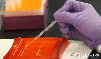 Alberta study shows DNA may not actually be good predictor of disease, health