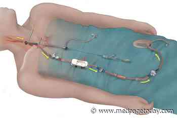 Study: Transcarotid Stenting Has a Leg Up Over Femoral Approach