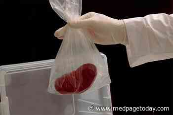 HHS Kidney Donation Proposed Rules Win Plaudits