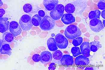 B Cell Protein Proves Out as Novel Myeloma Target