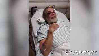 73-year-old grandfather severely injured after being attacked while looking at Christmas lights