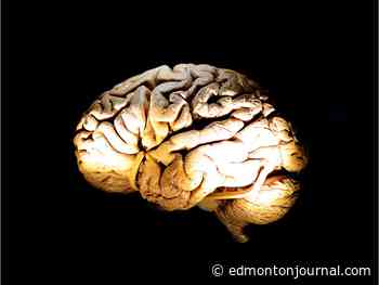 MRIs show brains of adolescents struggling with mental illness wired differently: University of Alberta study