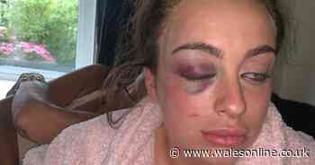 Woman feared she'd die as rugby player choked and strangled her in horrific attack