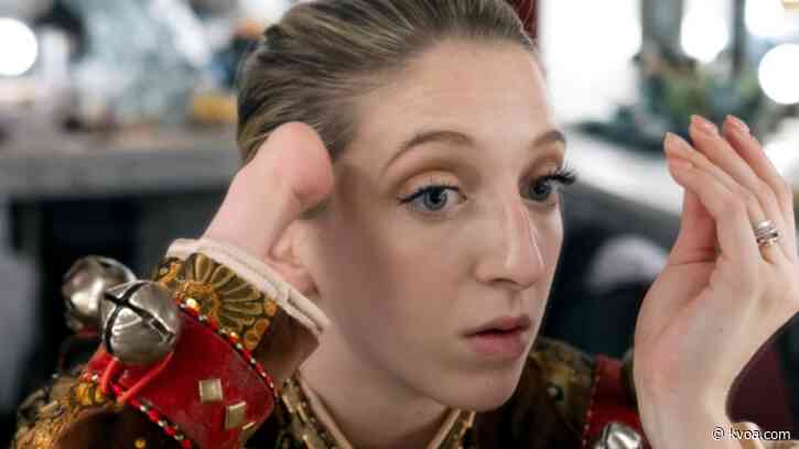 Dancer born with one hand hired by NY’s famed Radio City Rockettes