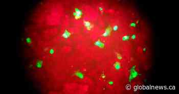 Why this year’s flu season could be particularly dangerous for kids