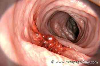 Colorectal Cancer: Does Continuing Induction Chemo Do Any Good?