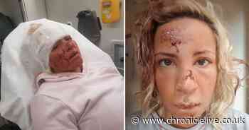 Walker woman suffers horrific facial injuries in crash just two days before Christmas
