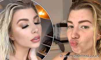 Olivia Buckland says the contraceptive pill brought on her acne...as she shares miraculous makeover