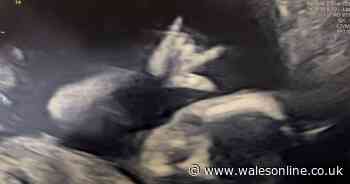 'Let's rock' Unborn baby seen making a heavy metal sign in the womb during scan