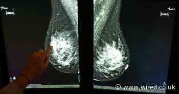DeepMind's new AI can spot breast cancer just as well as your doctor