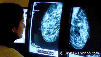 AI system can detect breast cancer better than clinical experts – study