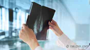 Google's AI system can beat doctors at detecting breast cancer