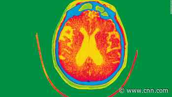 Opinion: Lessons from a high-powered, 64-year-old attorney's first brush with Alzheimer's disease