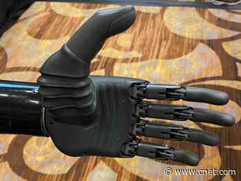You can move this prosthetic hand with your mind     - CNET