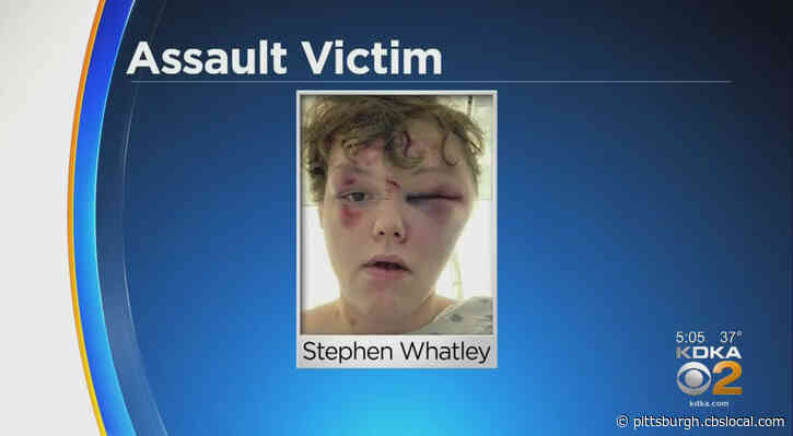 Police: 16-Year-Old Facing Attempted Homicide Charges Now Under Arrest After Aluminum Baseball Bat Attack During Robbery