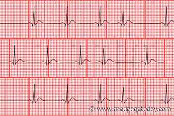 Premature Atrial Contractions: Benign or Malignant?